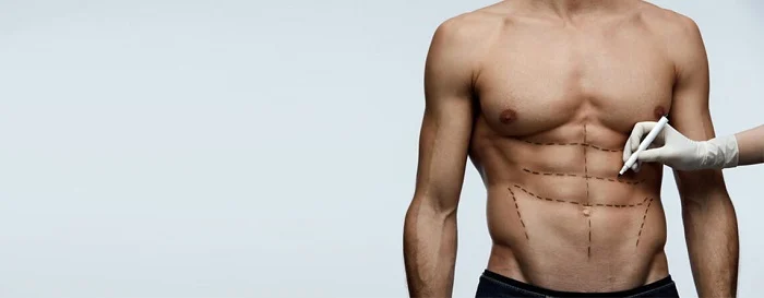 The difference between abdominoplasty and lipomatics
