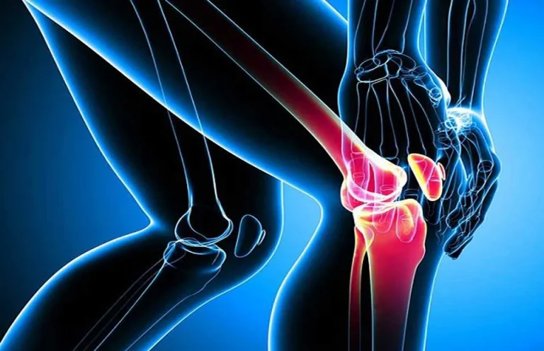 تفاوت رویکرد در کتاب‌های ارتوپدی اپلی و کمبل
